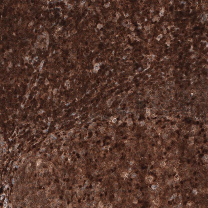 Profilin 1 Antibody (CL3524) - BSA Free Immunohistochemistry-Paraffin: Profilin 1 Antibody (CL3524) [NBP2-59778]