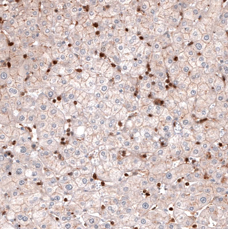 Profilin 1 Antibody (CL3524) - BSA Free Immunohistochemistry-Paraffin: Profilin 1 Antibody (CL3524) [NBP2-59778]