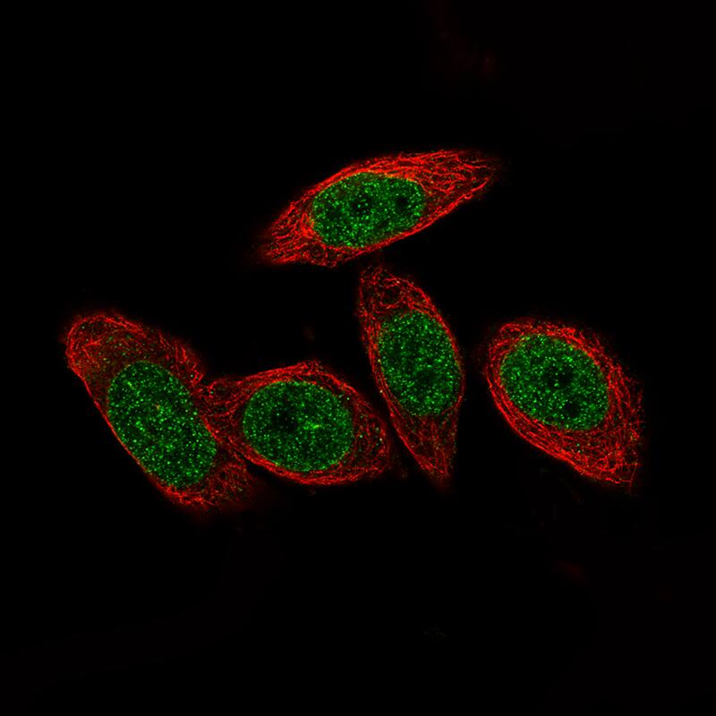 Macro H2A.2 Antibody (CL5263) - BSA Free Immunocytochemistry/ Immunofluorescence: Macro H2A.2 Antibody (CL5263) [NBP2-61156]