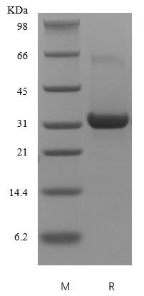 Recombinant Human IGFBP-5 Protein