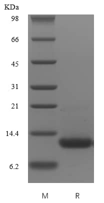 Recombinant Human MIA Protein