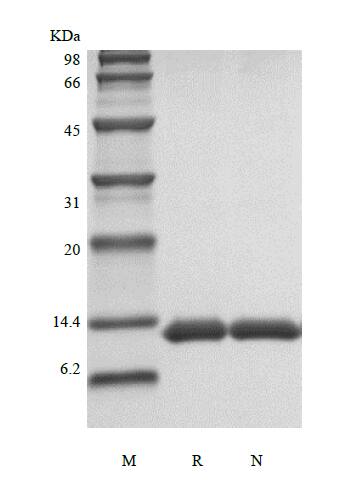 Recombinant Human Serum Amyloid A1 Protein SDS-PAGE: Recombinant Human Serum Amyloid A Protein [NBP2-61366] -