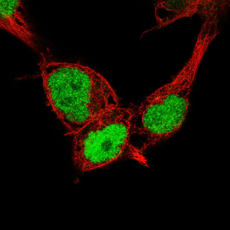 Nanog Antibody (CL5803) - BSA Free Immunocytochemistry/ Immunofluorescence: Nanog Antibody (CL5803) [NBP2-61428]