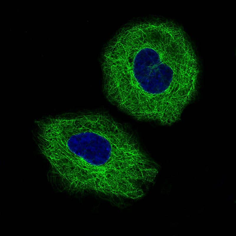 beta-III Tubulin Antibody (CL5813) - BSA Free Immunocytochemistry/ Immunofluorescence: beta-III Tubulin Antibody (CL5813) [NBP2-61430]