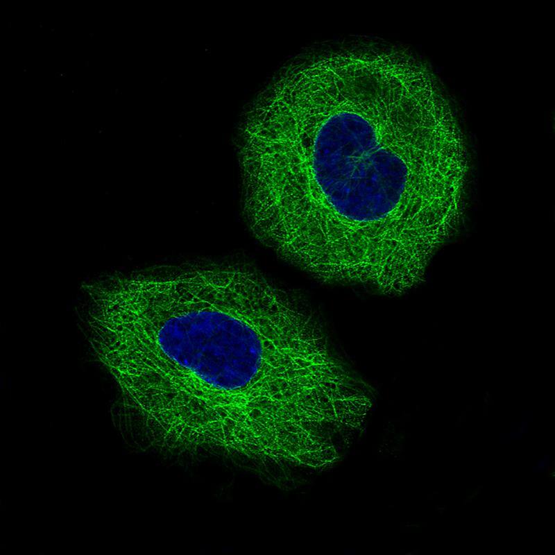 beta-III Tubulin Antibody (CL5813) - BSA Free Immunocytochemistry/ Immunofluorescence: beta-III Tubulin Antibody (CL5813) [NBP3-52481]