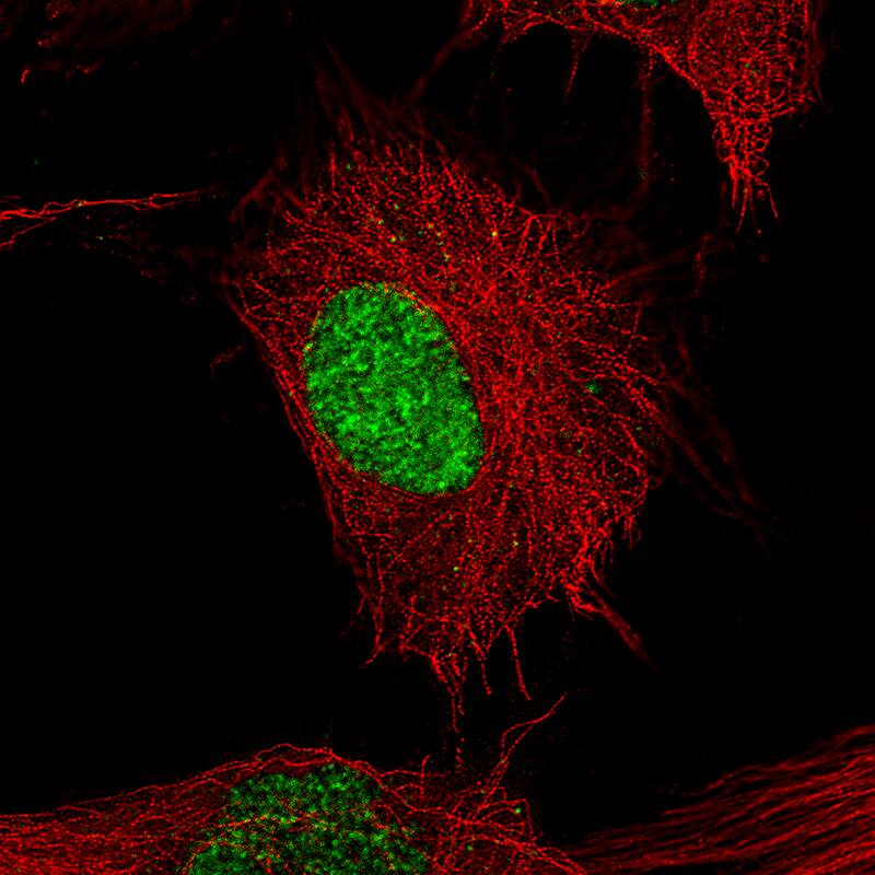 POU3F2/OCT7 Antibody (CL6228) - BSA Free Immunocytochemistry/ Immunofluorescence: POU3F2/OCT7 Antibody (CL6228) [NBP2-61436]