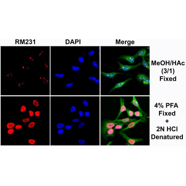 5-MethylCytosine Antibody (RM231)