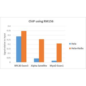 Histone H3 [ac Lys79] Antibody (RM156)