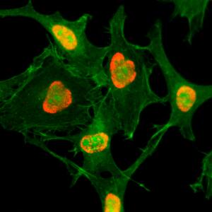 Histone H3 [ac Lys79] Antibody (RM156)
