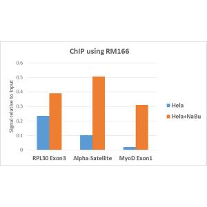 Histone H3 [ac Lys18] Antibody (RM166)