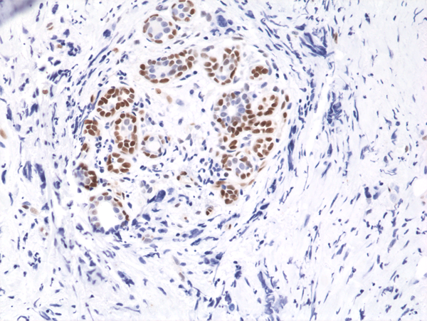 STAT3 [p Tyr705] Antibody (RM261)