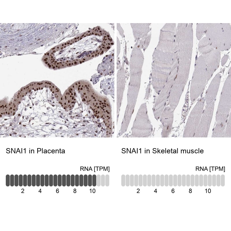 Snail Antibody (CL3700) - BSA Free Immunohistochemistry: Snail Antibody (CL3700) [NBP3-52471]