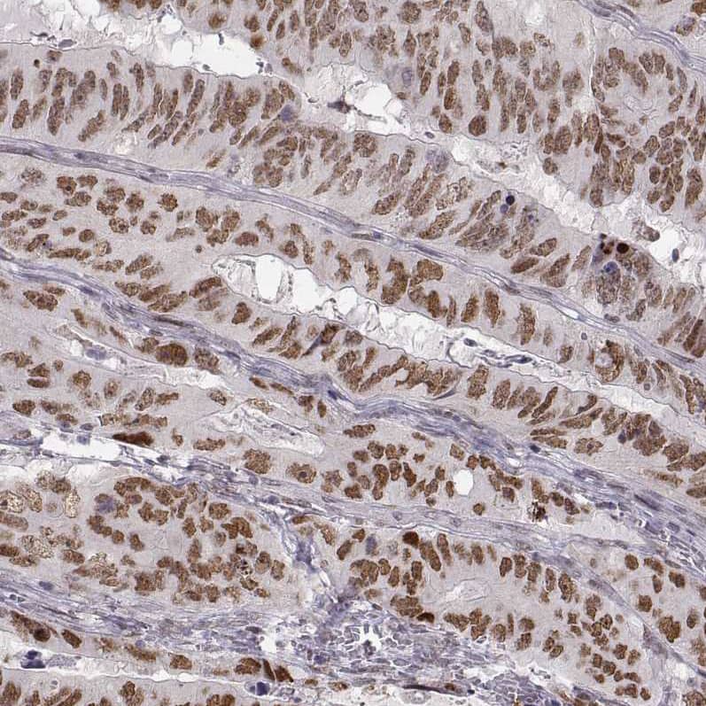 Snail Antibody (CL3700) - BSA Free Immunohistochemistry: Snail Antibody (CL3700) [NBP3-52471]