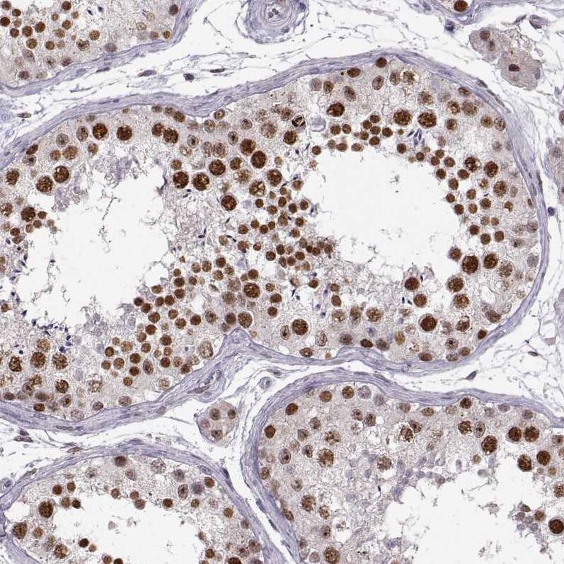 Snail Antibody (CL3700) - BSA Free Immunohistochemistry: Snail Antibody (CL3700) [NBP3-52471]