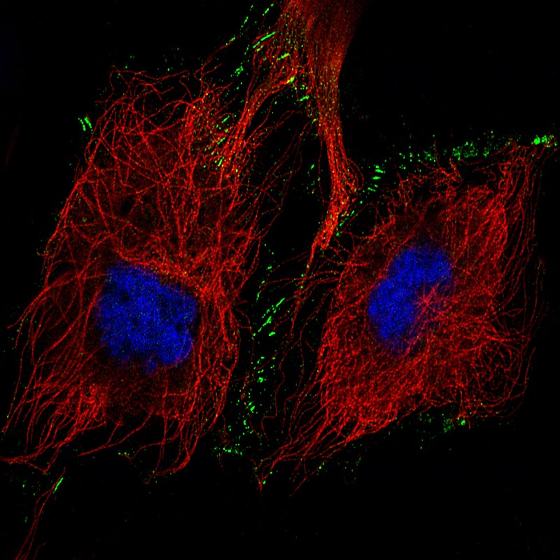 N-Cadherin Antibody (CL3716) - BSA Free Immunocytochemistry/ Immunofluorescence: N-Cadherin Antibody (CL3716) [NBP2-61632]