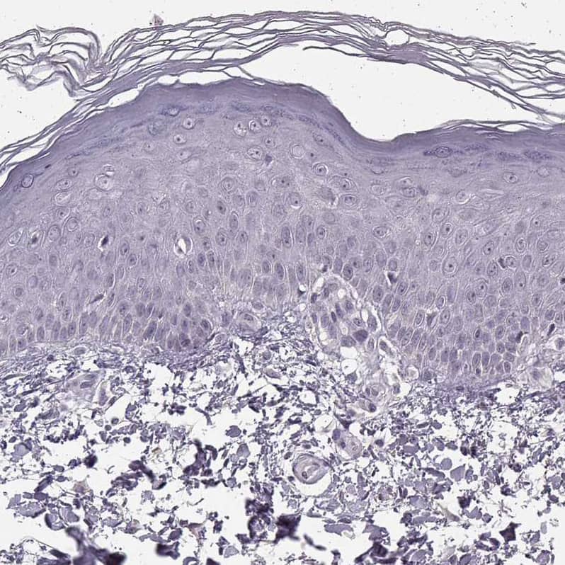 N-Cadherin Antibody (CL3716) - BSA Free Immunohistochemistry-Paraffin: N-Cadherin Antibody (CL3716) [NBP2-61632]
