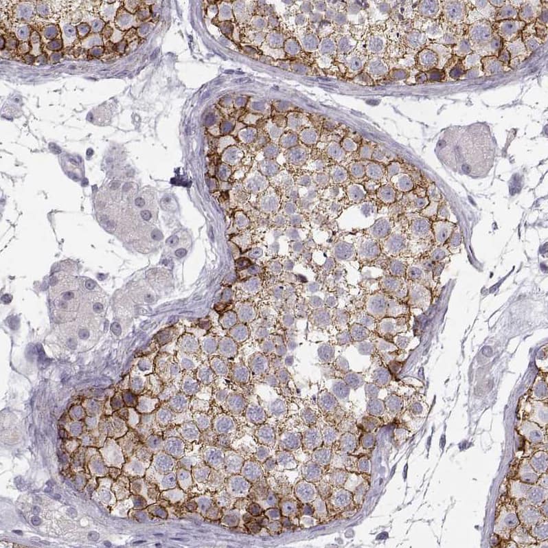 N-Cadherin Antibody (CL3716) - BSA Free Immunohistochemistry-Paraffin: N-Cadherin Antibody (CL3716) [NBP2-61632]