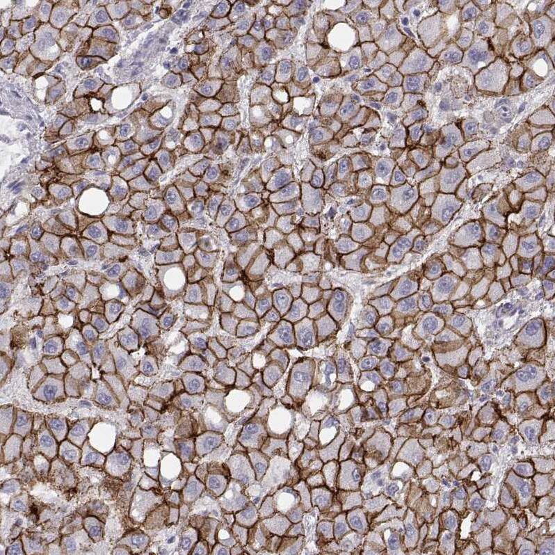 N-Cadherin Antibody (CL3716) - BSA Free Immunohistochemistry-Paraffin: N-Cadherin Antibody (CL3716) [NBP2-61632]