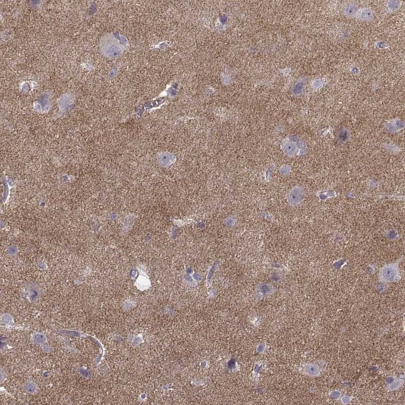 N-Cadherin Antibody (CL3716) - BSA Free Immunohistochemistry-Paraffin: N-Cadherin Antibody (CL3716) [NBP2-61632]