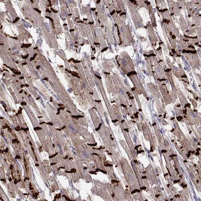 N-Cadherin Antibody (CL3716) - BSA Free Immunohistochemistry-Paraffin: N-Cadherin Antibody (CL3716) [NBP2-61632]