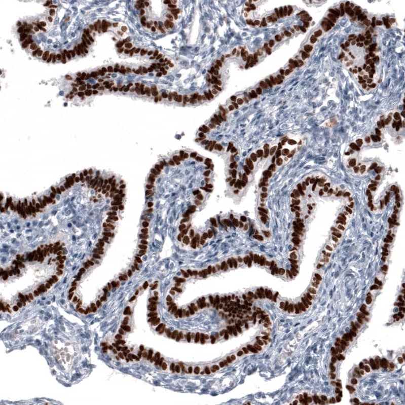 GRHL2 Antibody (CL3760) - BSA Free Immunohistochemistry-Paraffin: GRHL2 Antibody (CL3760) [NBP2-61634]
