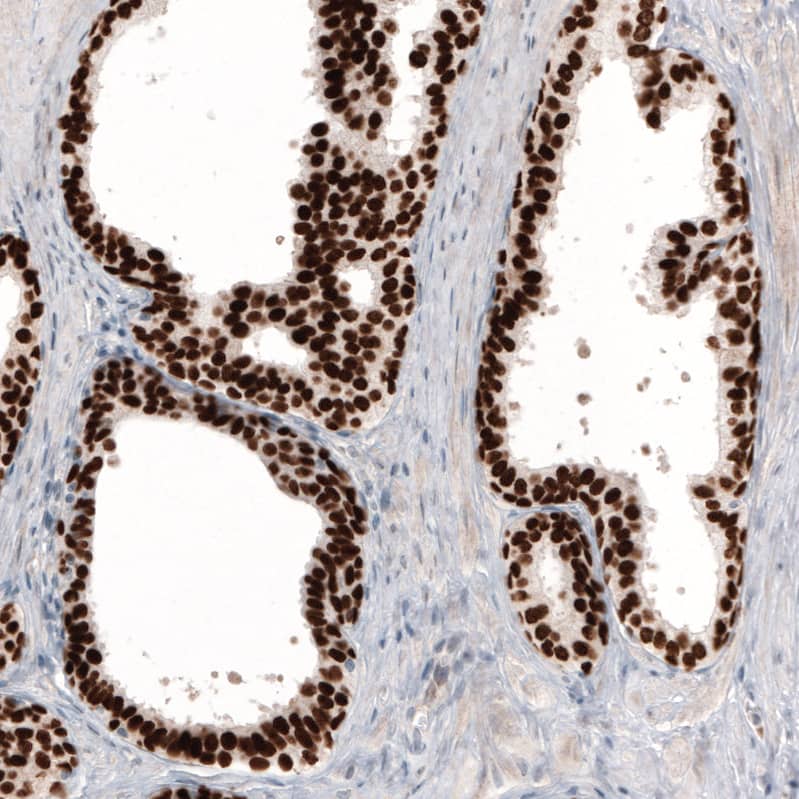 GRHL2 Antibody (CL3760) - BSA Free Immunohistochemistry-Paraffin: GRHL2 Antibody (CL3760) [NBP2-61634]