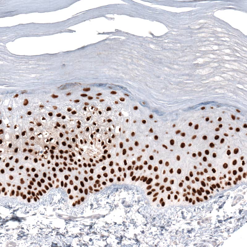 GRHL2 Antibody (CL3760) - BSA Free Immunohistochemistry-Paraffin: GRHL2 Antibody (CL3760) [NBP2-61634]
