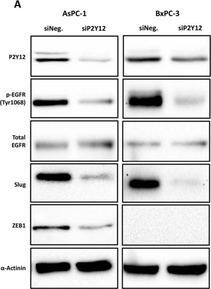P2Y12/P2RY12 Antibody (1C2A9) - BSA Free