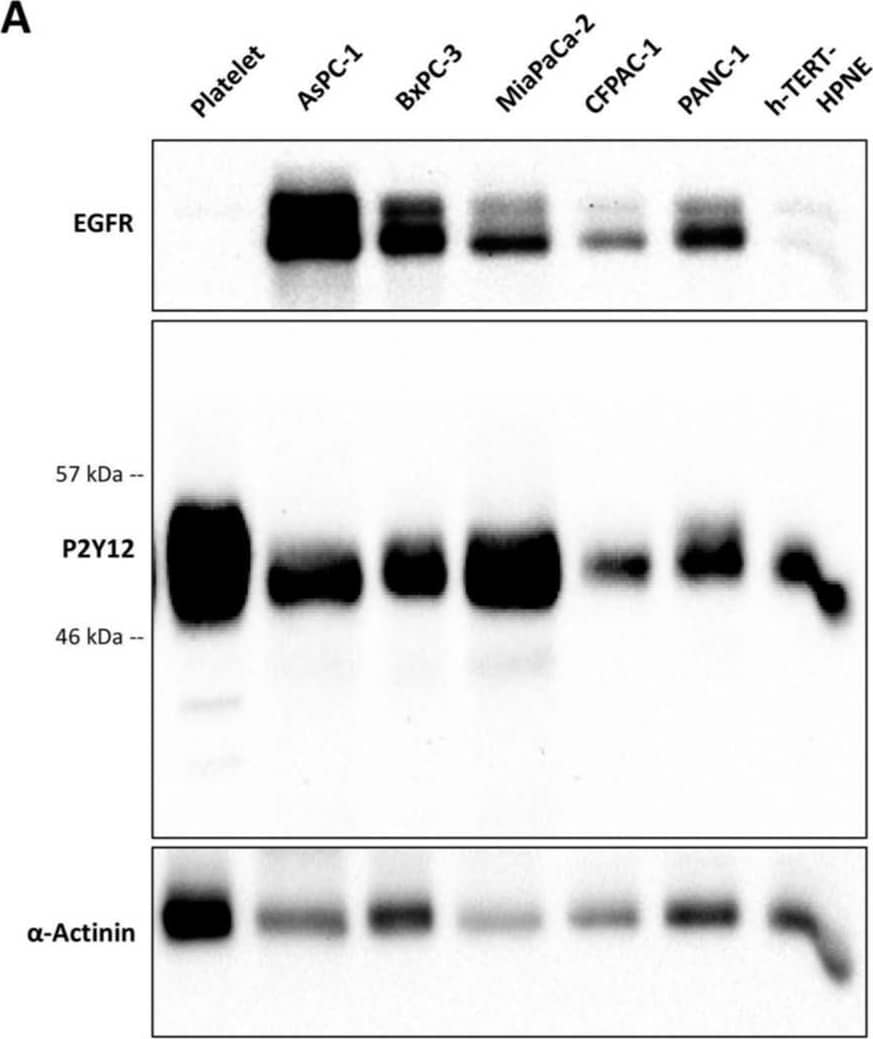 P2Y12/P2RY12 Antibody (1C2A9) - BSA Free