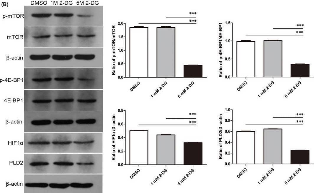 Phospholipase D2 Antibody (7E4D9) - BSA Free