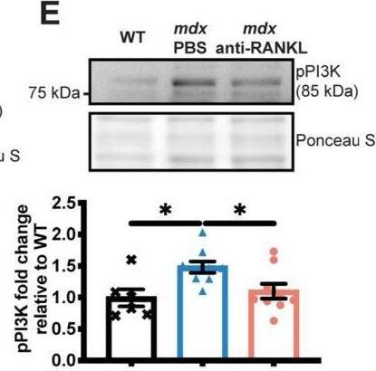 TRANCE/TNFSF11/RANK L Antibody (8A7B9) - BSA Free
