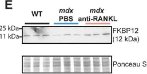 TRANCE/TNFSF11/RANK L Antibody (8A7B9) - BSA Free