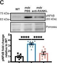 TRANCE/TNFSF11/RANK L Antibody (8A7B9) - BSA Free