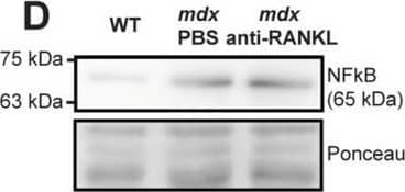 TRANCE/TNFSF11/RANK L Antibody (8A7B9) - BSA Free
