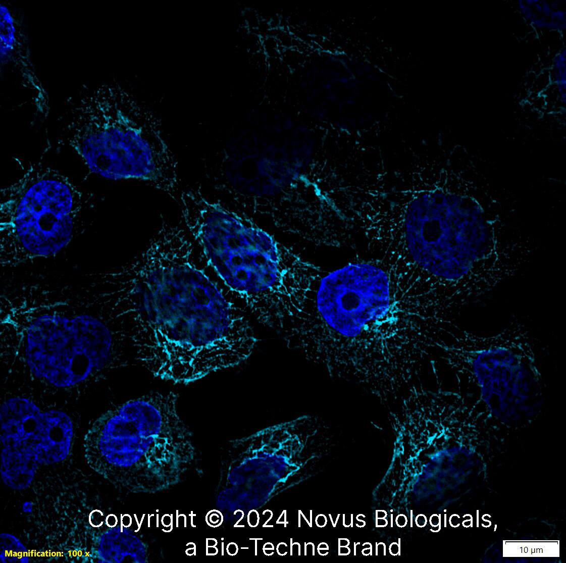 Cytokeratin 5 Antibody [Alexa Fluor® 647]