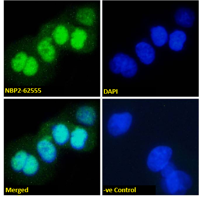 p53 Antibody (PAb421) - Chimeric - Azide and BSA Free