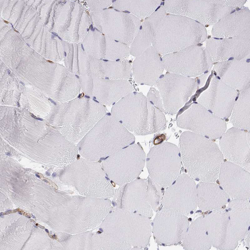 non-muscle Myosin IIA Antibody