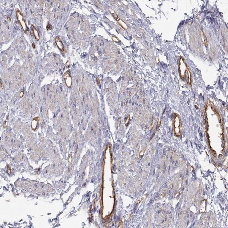 non-muscle Myosin IIA Antibody