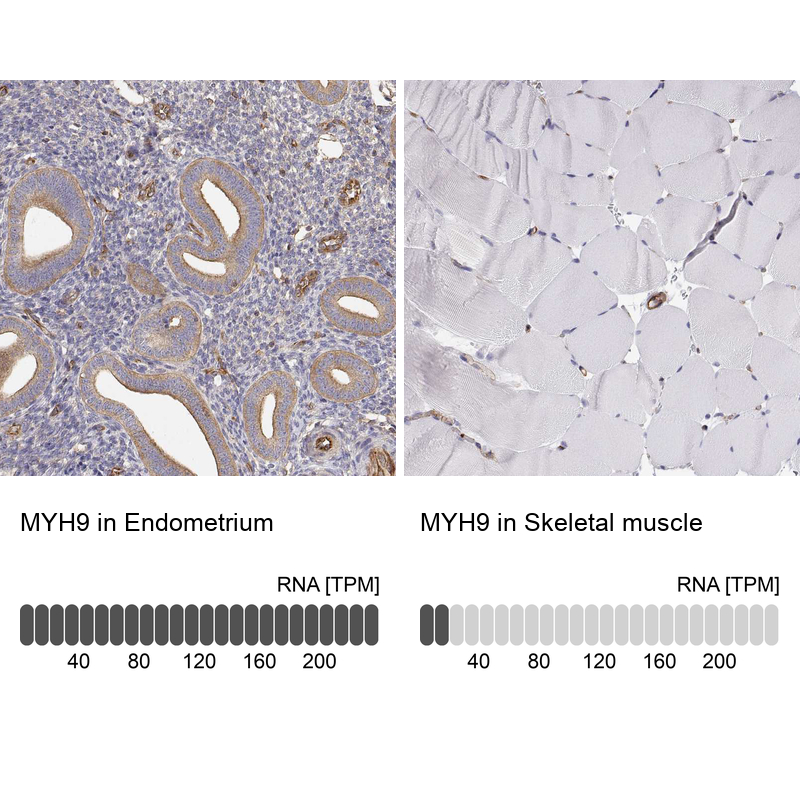 non-muscle Myosin IIA Antibody