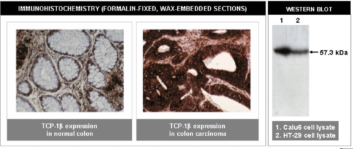 TCP1-beta Antibody (F39 P7 F11)