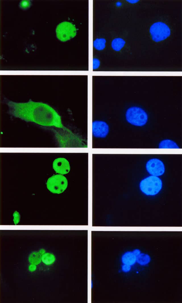 LEF1 Antibody (REMB6)