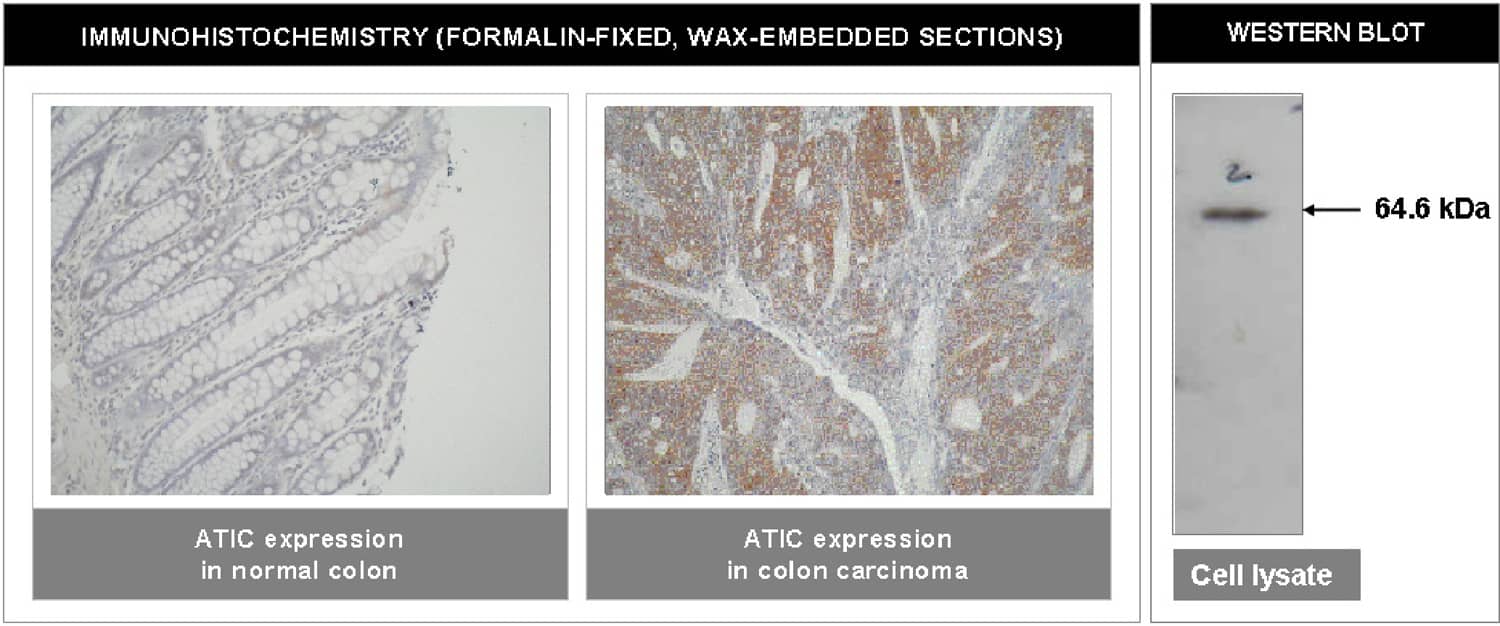 ATIC Antibody (F38 P7 H9)