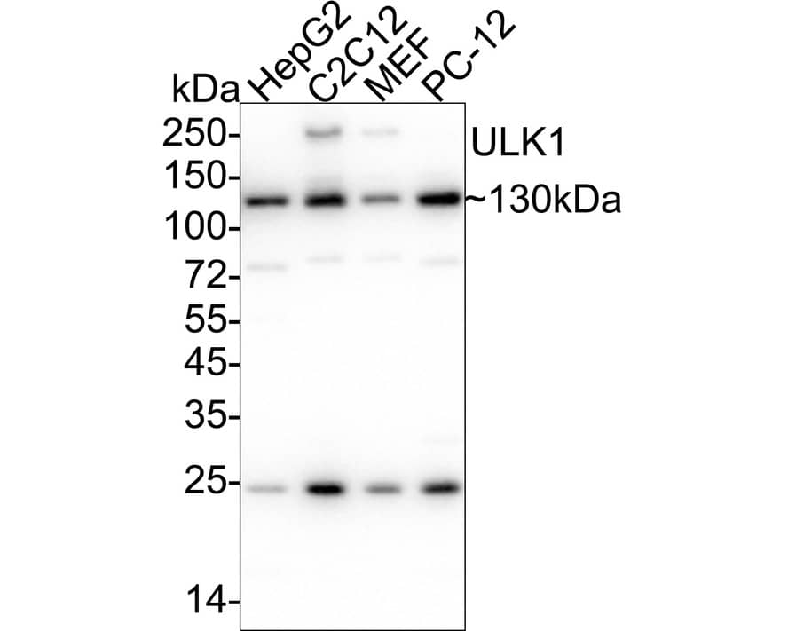ULK1 Antibody (JA58-36) Western Blot: ULK1 Antibody (JA58-36) [NBP2-66765]