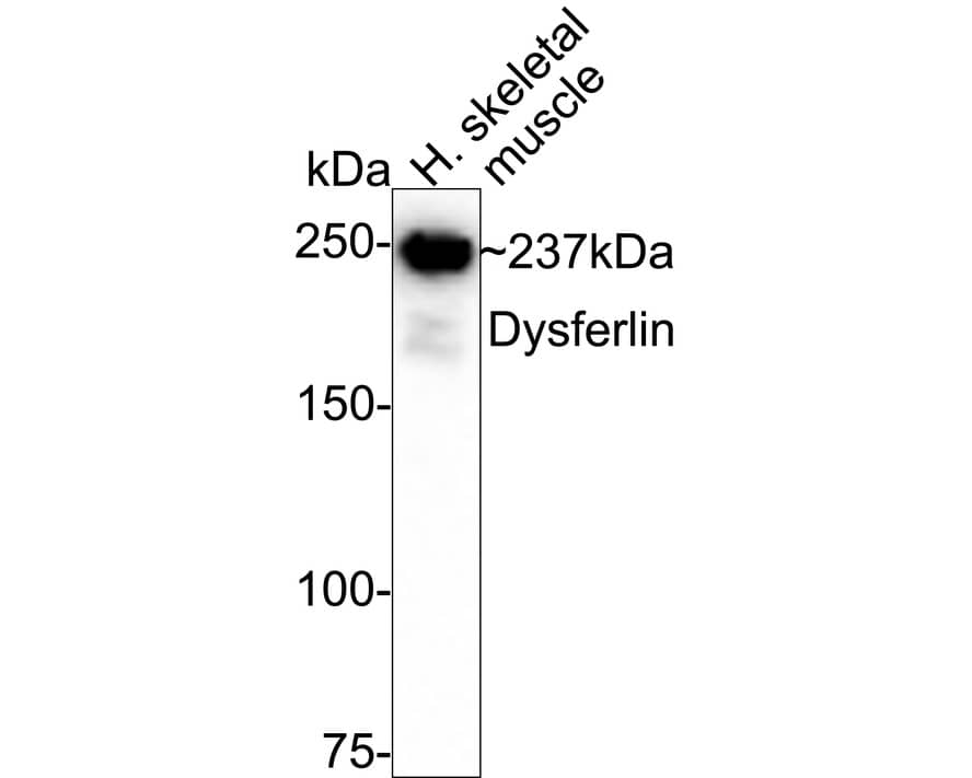 Dysferlin Antibody (JF05-54) Western Blot: Dysferlin Antibody (JF05-54) [NBP2-66814]