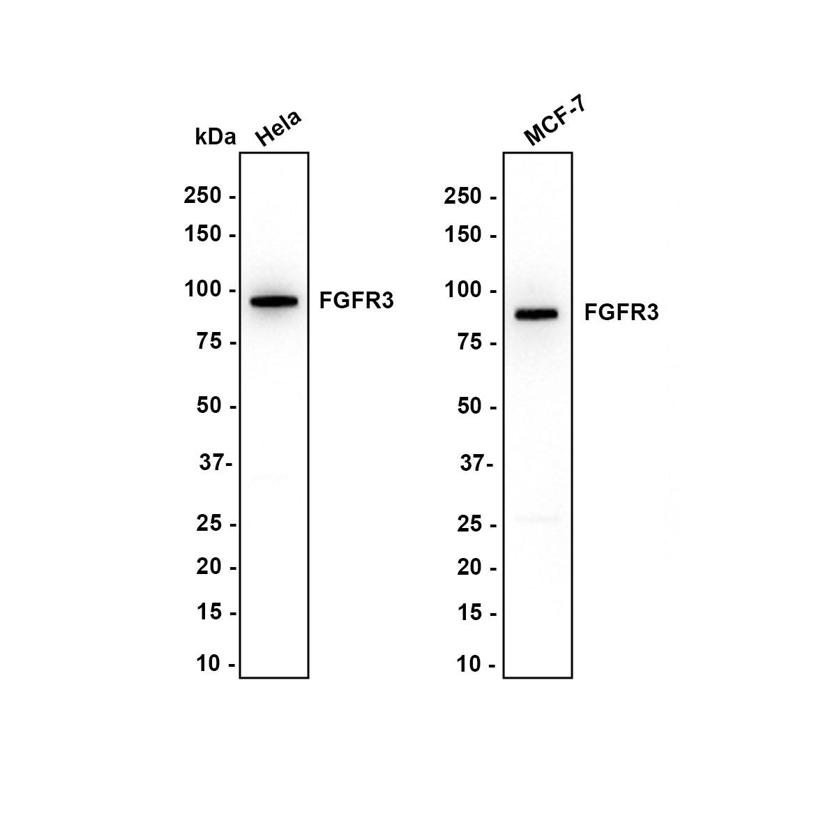 FGFR3 Antibody (JM110-33) Western Blot: FGFR3 Antibody (JM110-33) [NBP2-66840]