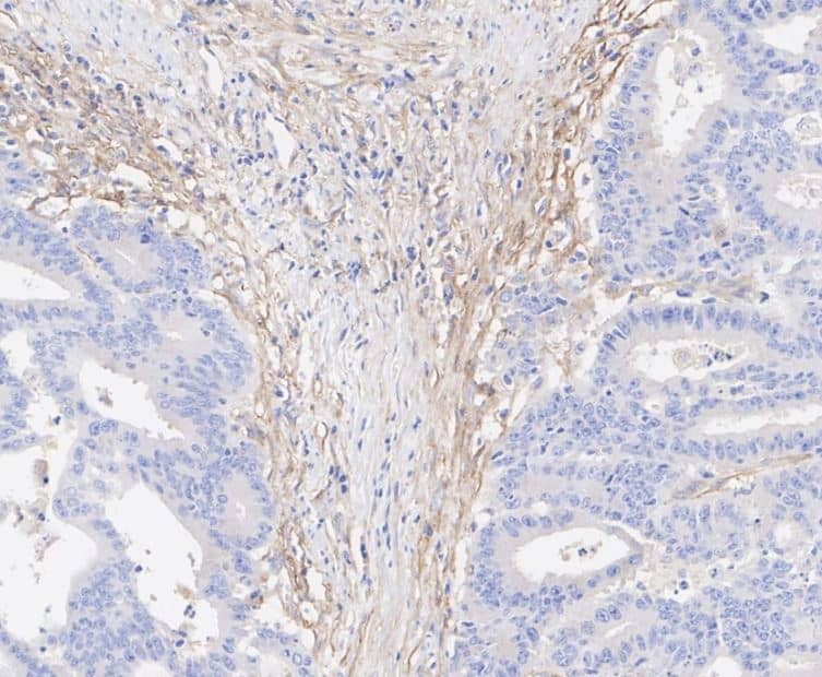 Fibroblast Activation Protein alpha/FAP Antibody (JA56-11)