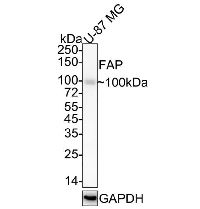 Fibroblast Activation Protein alpha/FAP Antibody (JA56-11)