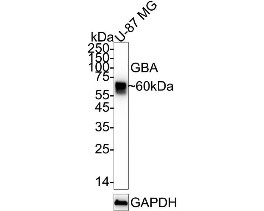 Glucosylceramidase/GBA Antibody (JM10-76) Western Blot: Glucosylceramidase/GBA Antibody (JM10-76) [NBP2-66871]
