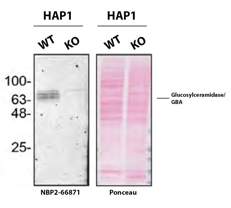 Glucosylceramidase/GBA Antibody (JM10-76) Western Blot Shows Glucosylceramidase/GBA Specificity Using Knockout Cell Line.