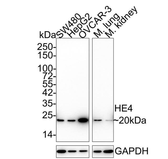 HE4/WFDC2 Antibody (JF62-09)